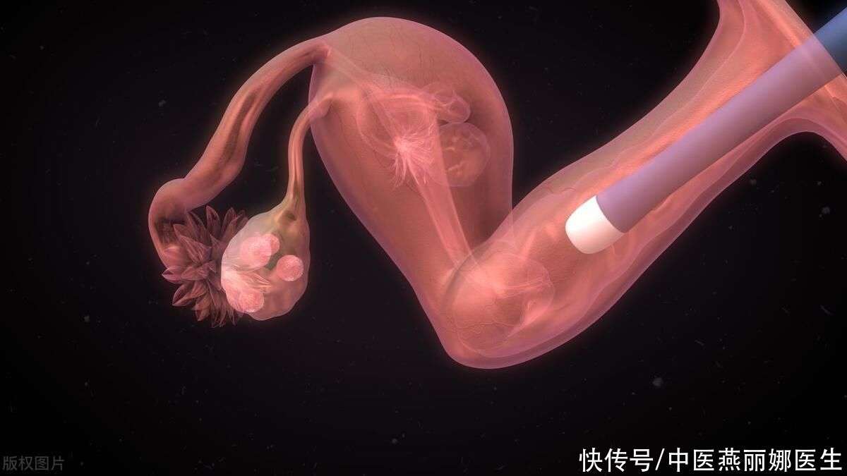 受精卵着床