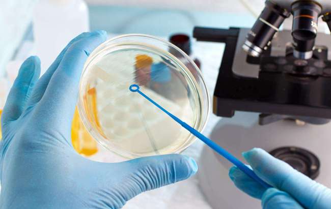 受精卵着床出血