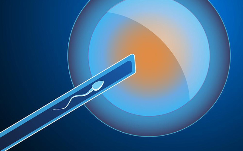 石家庄第三代试管婴儿